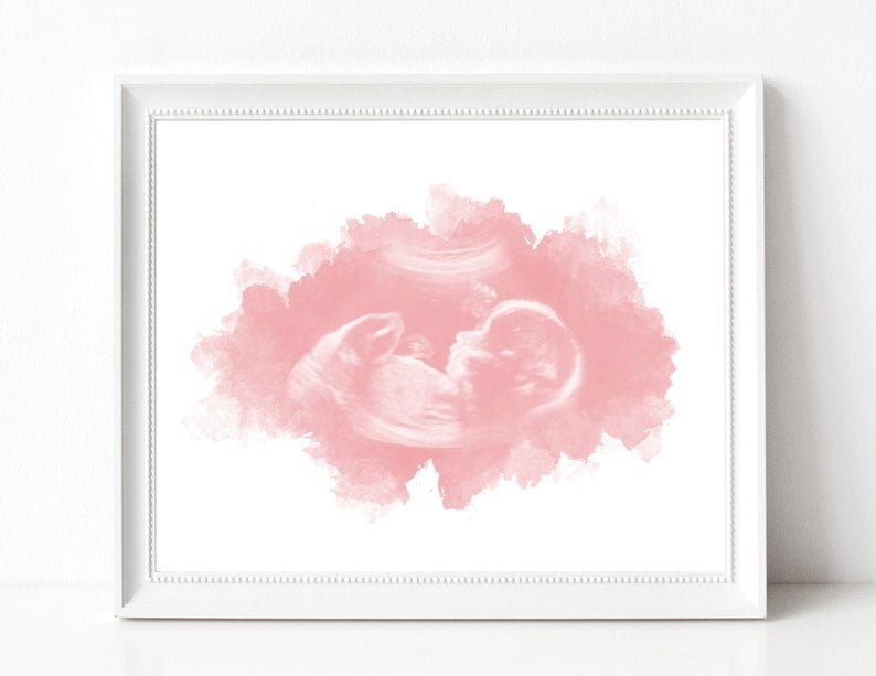 Baby Ultrasound Art