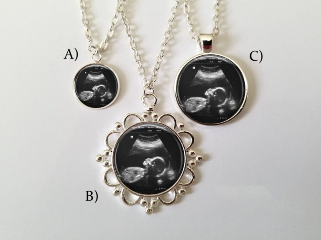 Ultrasound Charm Necklace